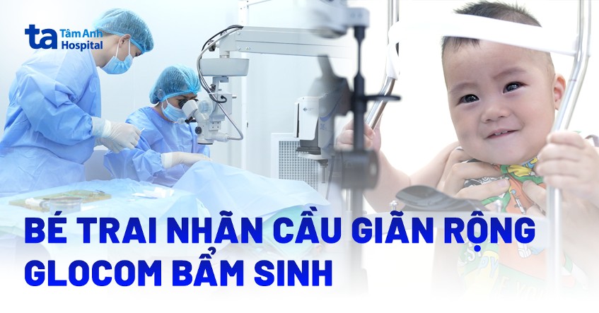 bé trai nhãn cầu giãn rộng glocom bẩm sinh