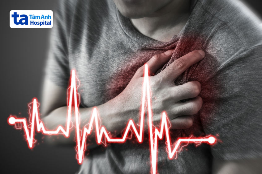 Bệnh nhân có tỷ lệ cao mắc block nhĩ thất độ 2 sau khi bị nhồi máu cơ tim