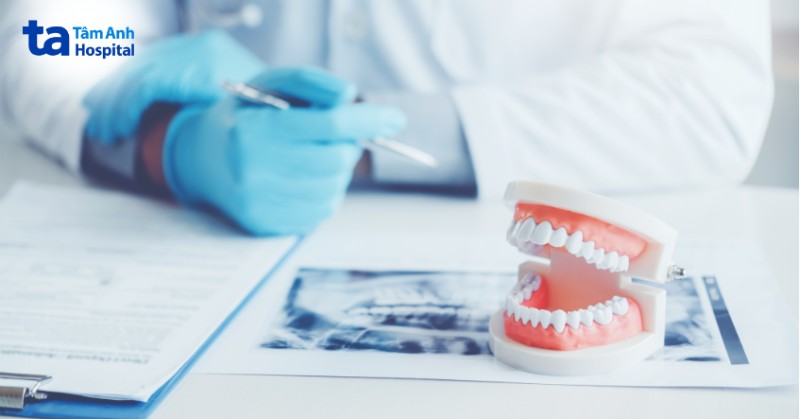 Chẩn đoán, phòng ngừa các biến chứng khi nhổ răng khôn
