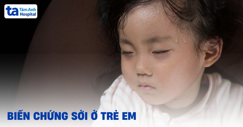 7 biến chứng sởi ở trẻ em và đối tượng dễ mắc di chứng