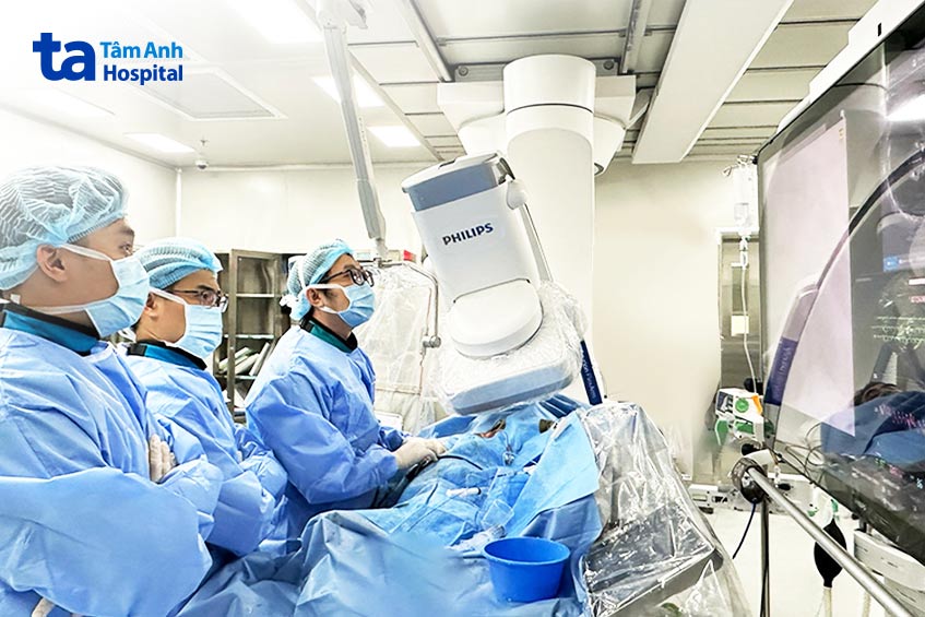 Bác sĩ Minh (ngoài cùng bên phải) cùng ê kíp can thiệp nong nhánh động mạch liên thất trước cho bệnh nhân ngoại quốc