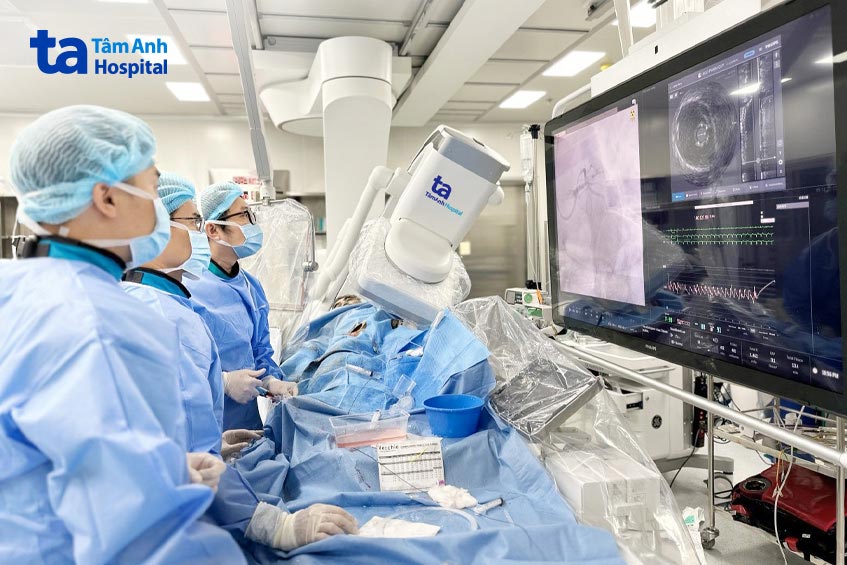 Các bác sĩ trong ca can thiệp thần tốc tái thông thân chung mạch vành trái cho bệnh nhân