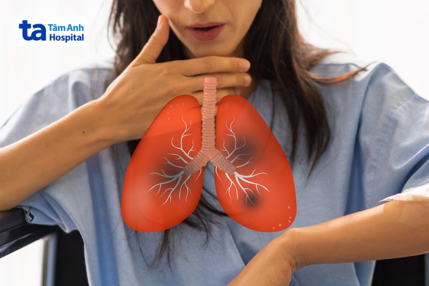 Các bệnh phổi nhiễm trùng có thể dẫn đến chứng suy hô hấp