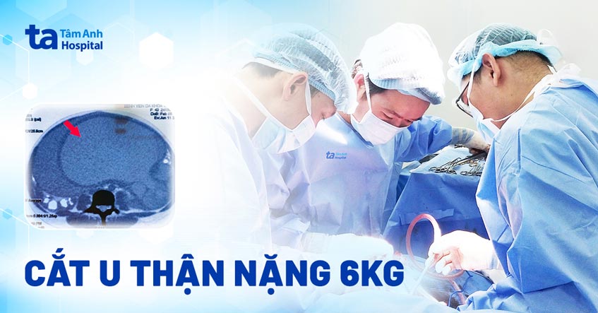 Cắt u thận nặng 6kg