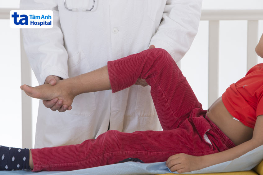 chẩn đoán tình trạng chân thấp chân cao ở trẻ