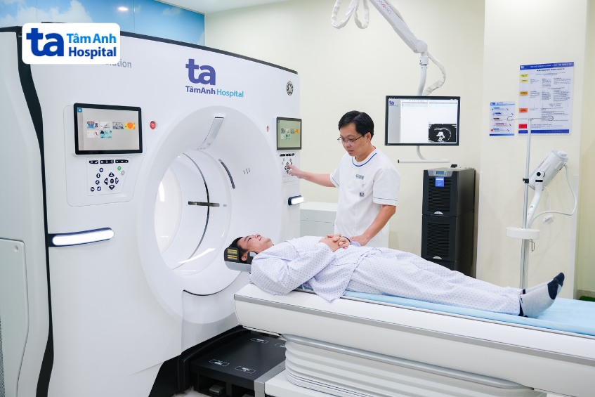 chẩn đoán u não thùy trán