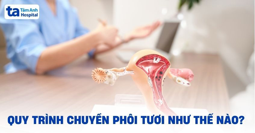 Chuyển phôi tươi là gì? Ưu điểm, chỉ định và quy trình [A-Z]