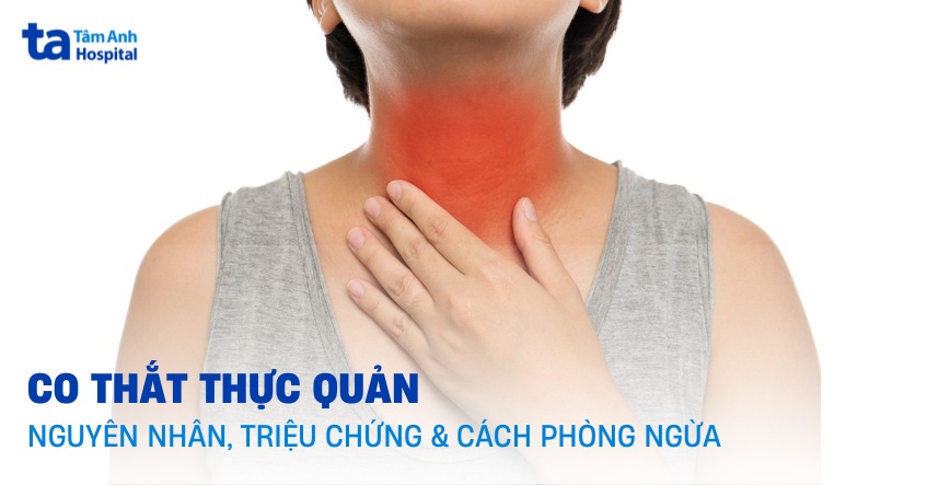 co thắt thực quản