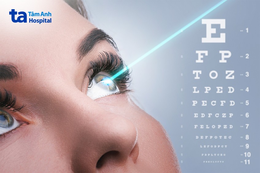 crosslinking giúp tăng độ bền cho giác mạc