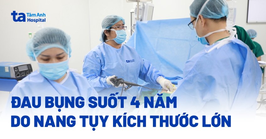 Đau bụng suốt 4 năm do nang tụy