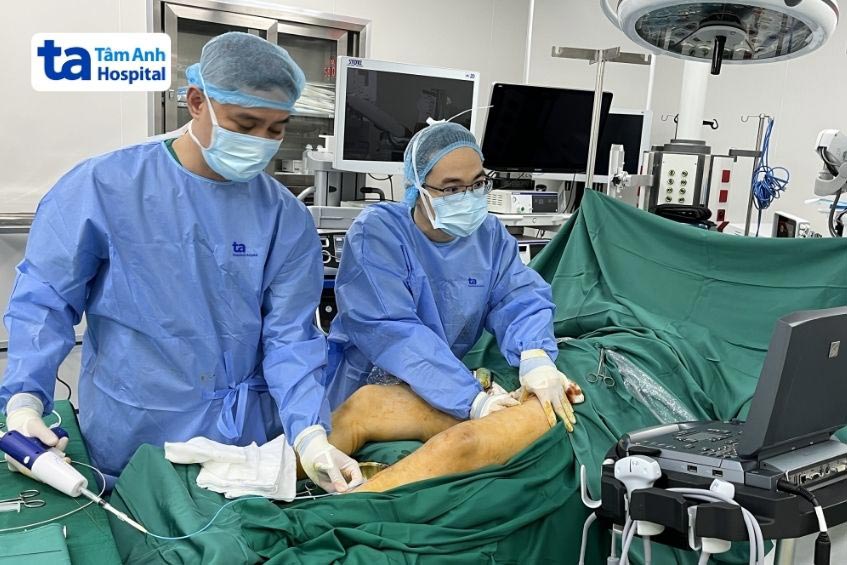 Điều trị suy giãn tĩnh mạch bằng các phương pháp hiện đại tại BVĐK Tâm Anh