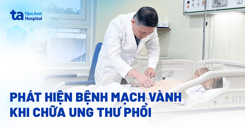 Điều trị ung thư phổi phát hiện bệnh mạch vành