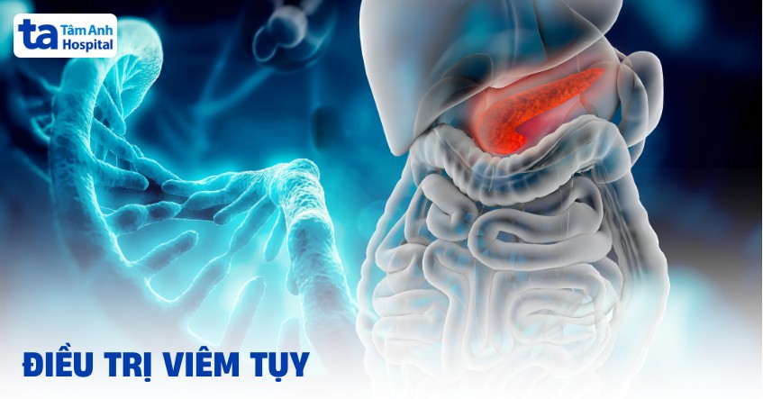 3 cách điều trị viêm tụy hiệu quả, an toàn và phổ biến hiện nay