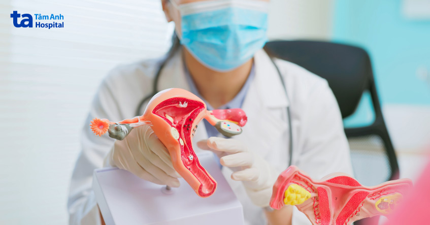 Độ dày nội mạc tử cung từ 8-14mm phù hợp để chuyển phôi