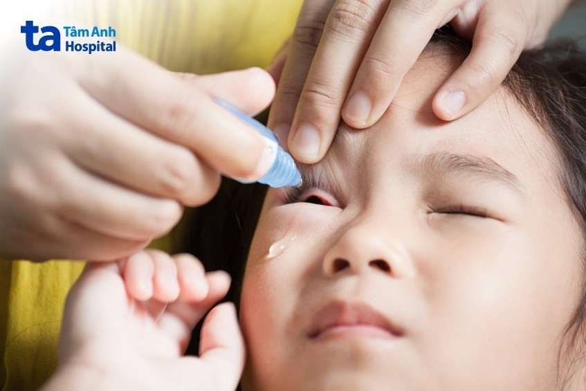 đối với trẻ em nên sử dụng thuốc nhỏ mắt theo chỉ định của bác sĩ