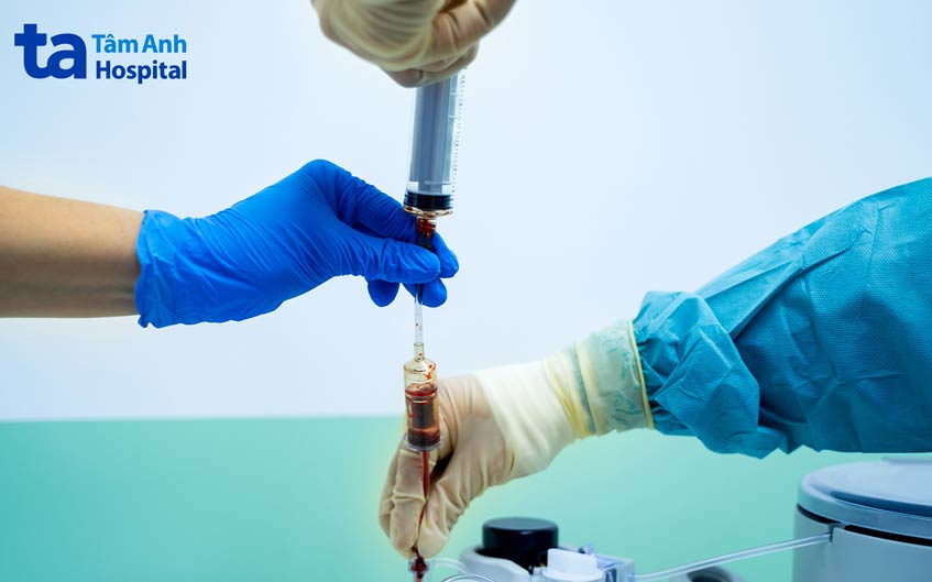 ghép tế bào gốc tự thân và ghép tế bào gốc đồng loại có tỷ lệ thành công khá cao