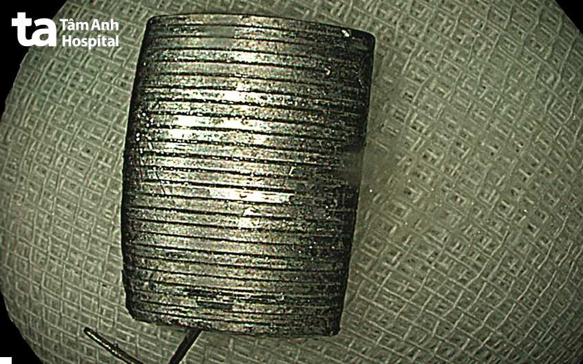 ghim bấm