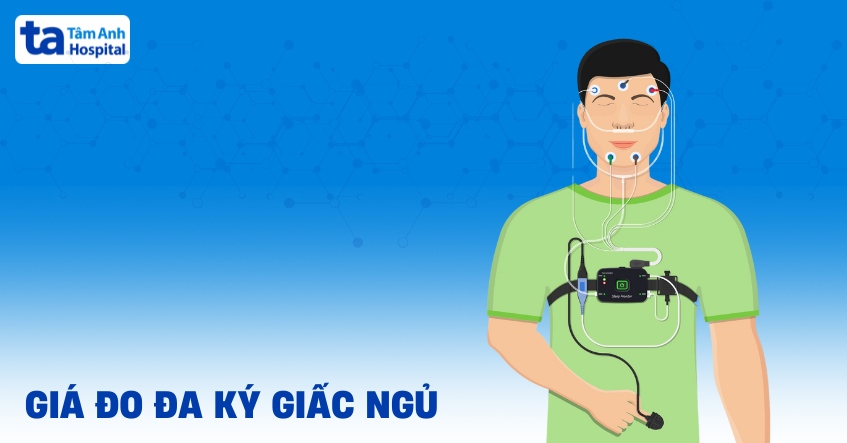 Giá đo đa ký giấc ngủ bao nhiêu tiền? 4 yếu tố ảnh hưởng chi phí