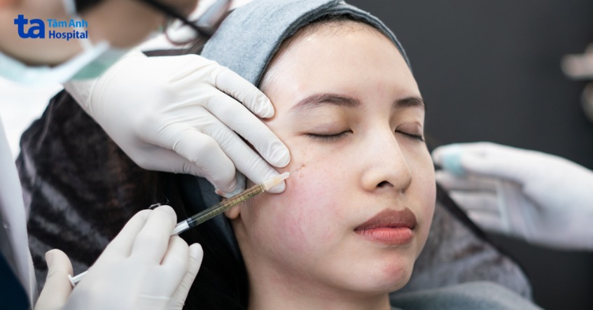 hiểu thêm về kĩ thuật tiêm meso