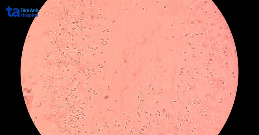 hình ảnh nhận biết xuất tinh ra máu