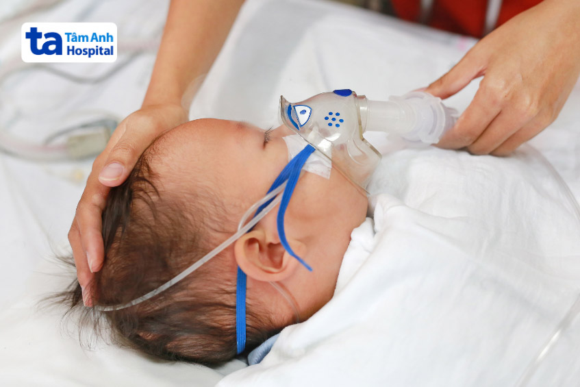 Hội chứng không lỗ van động mạch phổi làm ảnh hưởng đến hệ hô hấp, gây xẹp phổi, viêm phổi