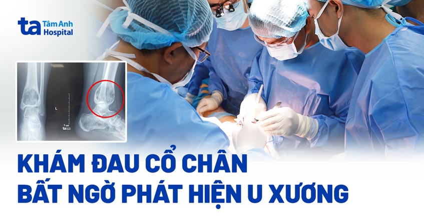 Khám đau cổ chân, bất ngờ phát hiện u xương
