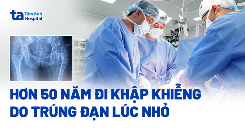 khập khiễng do trúng đạn từ nhỏ
