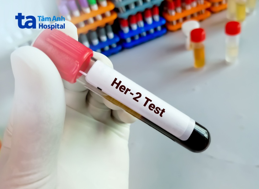 Kích thước của rìa phẫu thuật ung vú