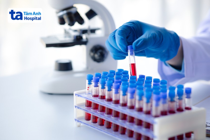 kỹ thuật xét nghiệm máu có thể áp dụng để kiểm tra bạch cầu ái kiềm