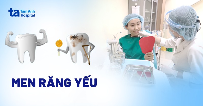 Men răng yếu: Nguyên nhân, dấu hiệu và cách khắc phục hiệu quả