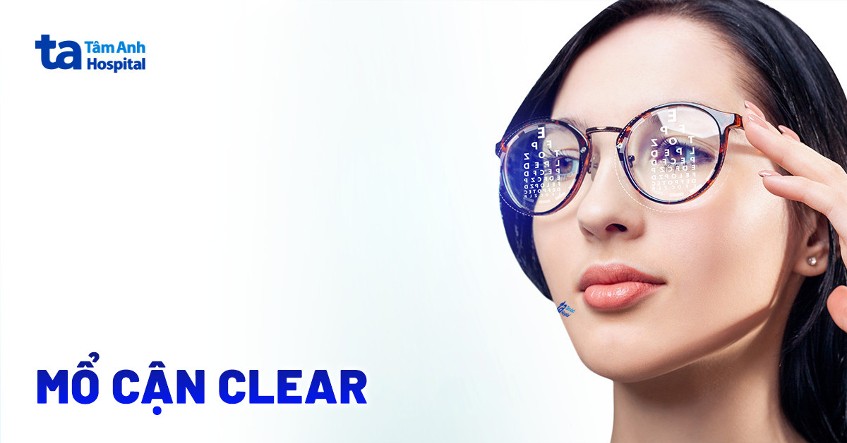 Mổ cận Clear là gì? Phương pháp, quy trình và chỉ định phẫu thuật