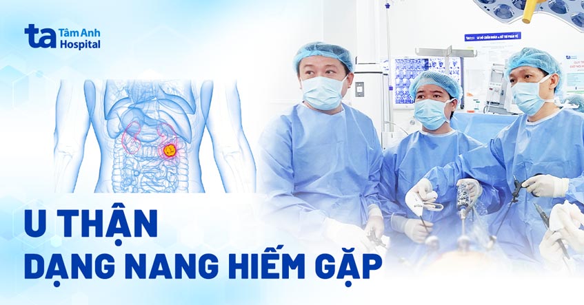 Nang thận lâu ngày hóa ung thư