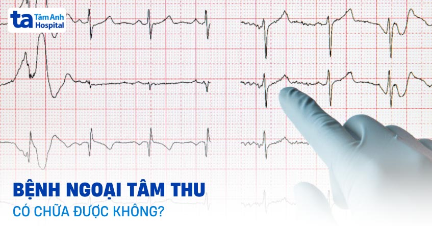 Ngoại tâm thu có chữa được không? Liệu có tự khỏi hẳn? [GIẢI ĐÁP]