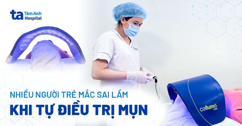 người trẻ mắc sai lầm khi tự điều trị mụn