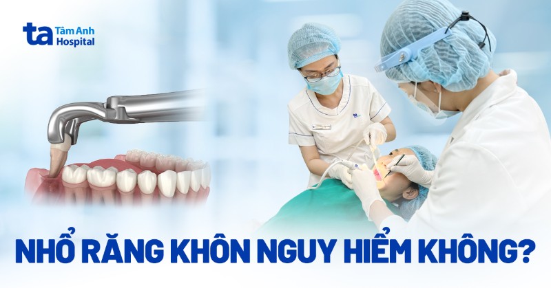 Nhổ răng khôn có nguy hiểm không? Có gây ảnh hưởng sức khỏe?