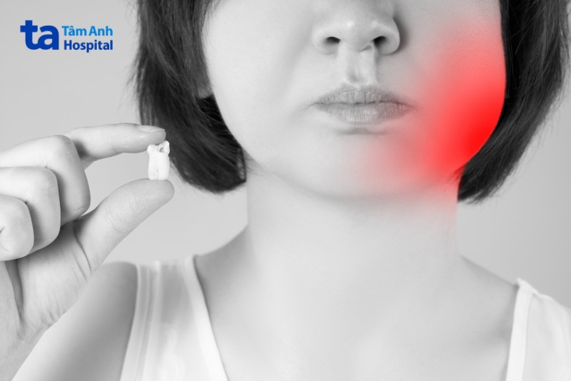 nhổ răng khôn có nguy hiểm, sưng tấy