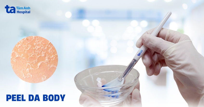 Tại sao nên chọn peel da body và từng bước thực hiện?