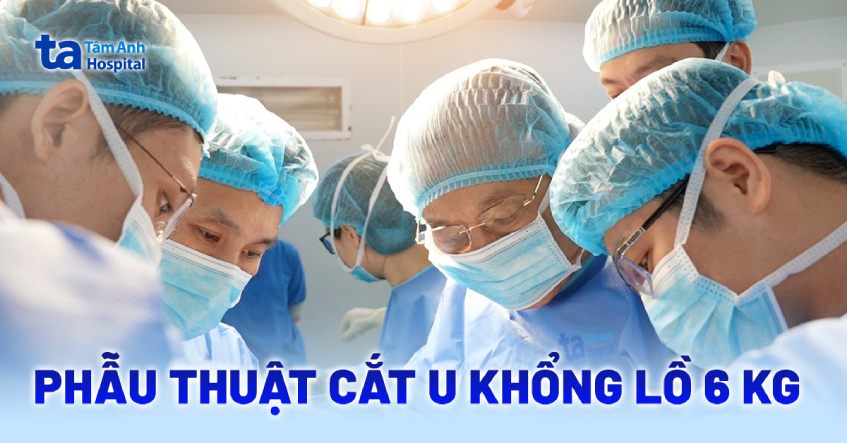 Cắt khối u 6 kg kèm đa phủ tạng