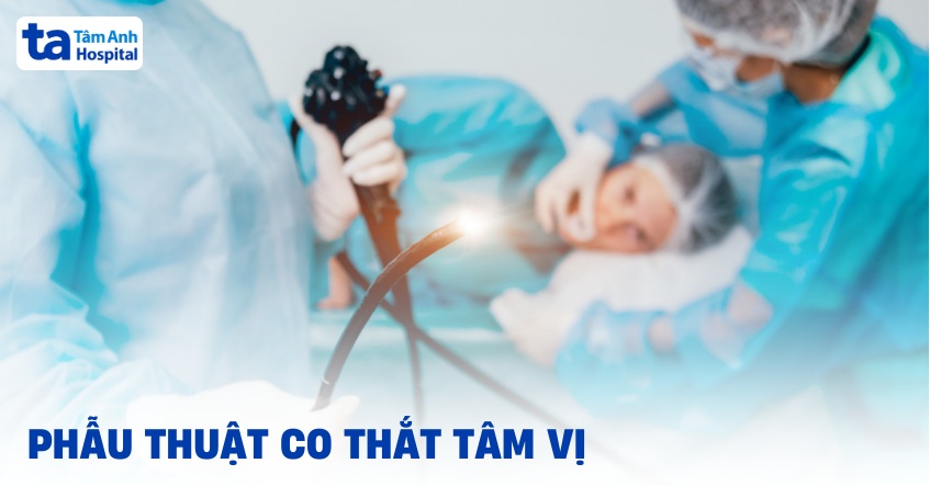 Phẫu thuật co thắt tâm vị: Đối tượng, quy trình và biến chứng