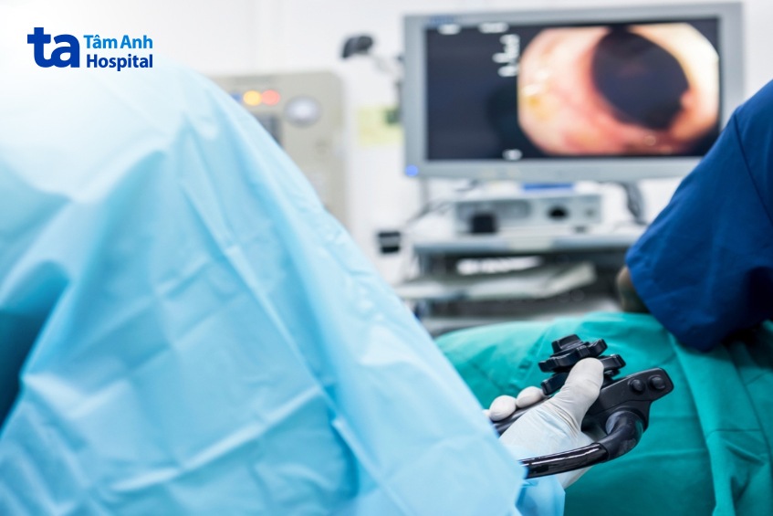 phẫu thuật điều trị ung thư trực tràng giai đoạn 2