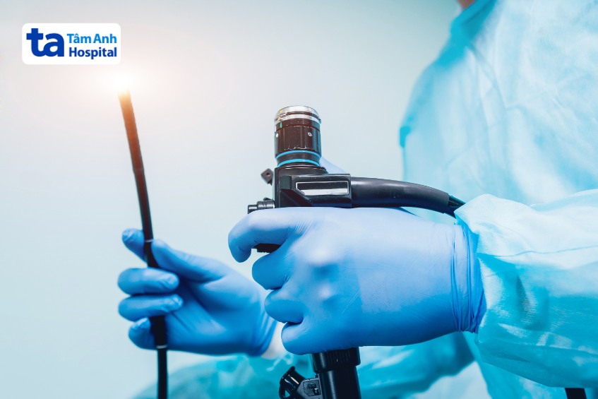 phẫu thuật nội soi co thắt tâm vị