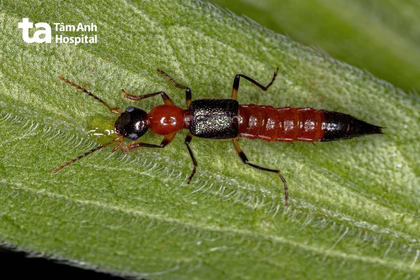 phòng ngừa kiến ba khoang