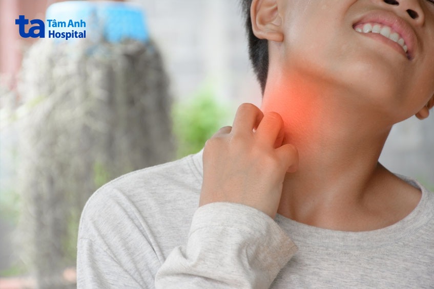 Phụ huynh nên cảnh giác với các u, hạch vùng cổ của trẻ