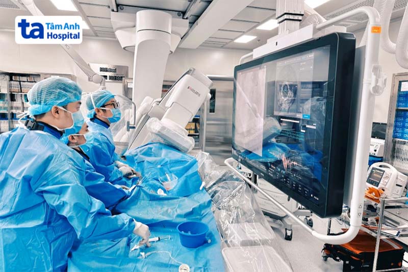 quy trình thực hiện siêu âm trong lòng mạch
