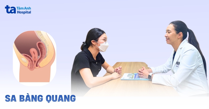 Sa bàng quang: Nguyên nhân, triệu chứng, chẩn đoán, phòng ngừa