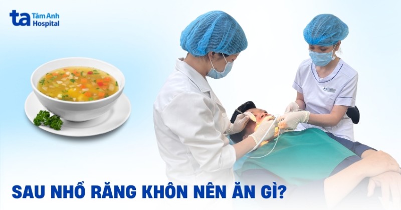 Sau khi nhổ răng khôn nên ăn gì, làm gì để nhanh hồi phục?