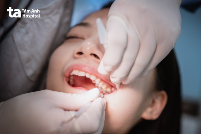 Vệ sinh răng miệng đúng cách