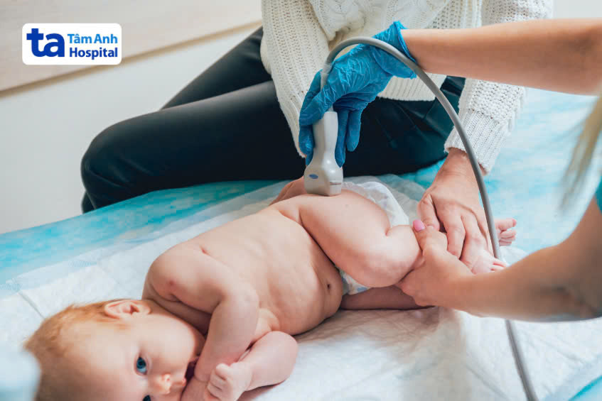 siêu âm chẩn đoán trật khớp háng ở trẻ sơ sinh