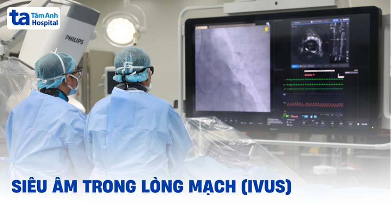 siêu âm trong lòng mạch