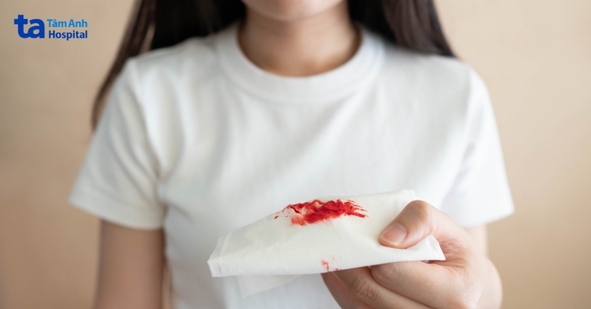 sổ mũi có máu